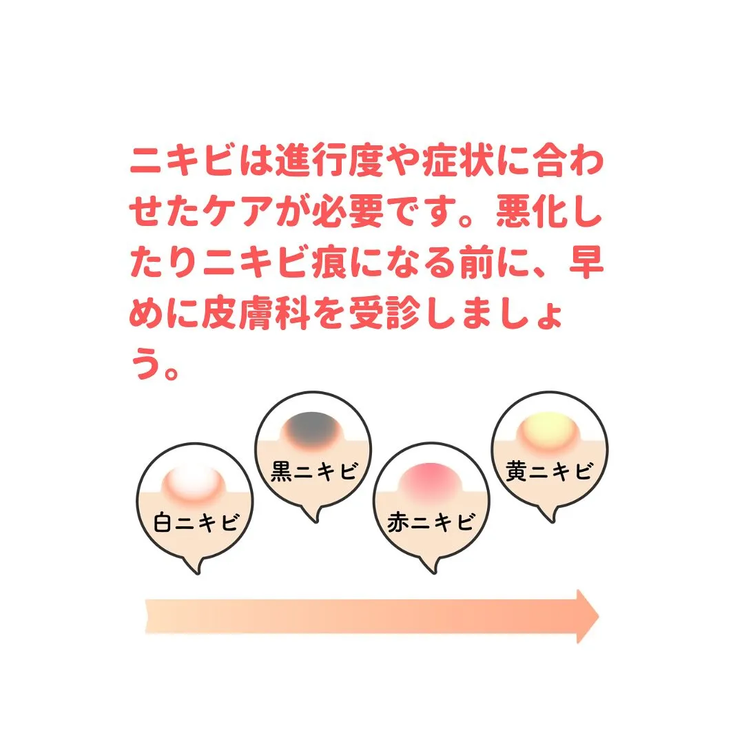 💊 薬剤師が教える身になるミニコラム 💊