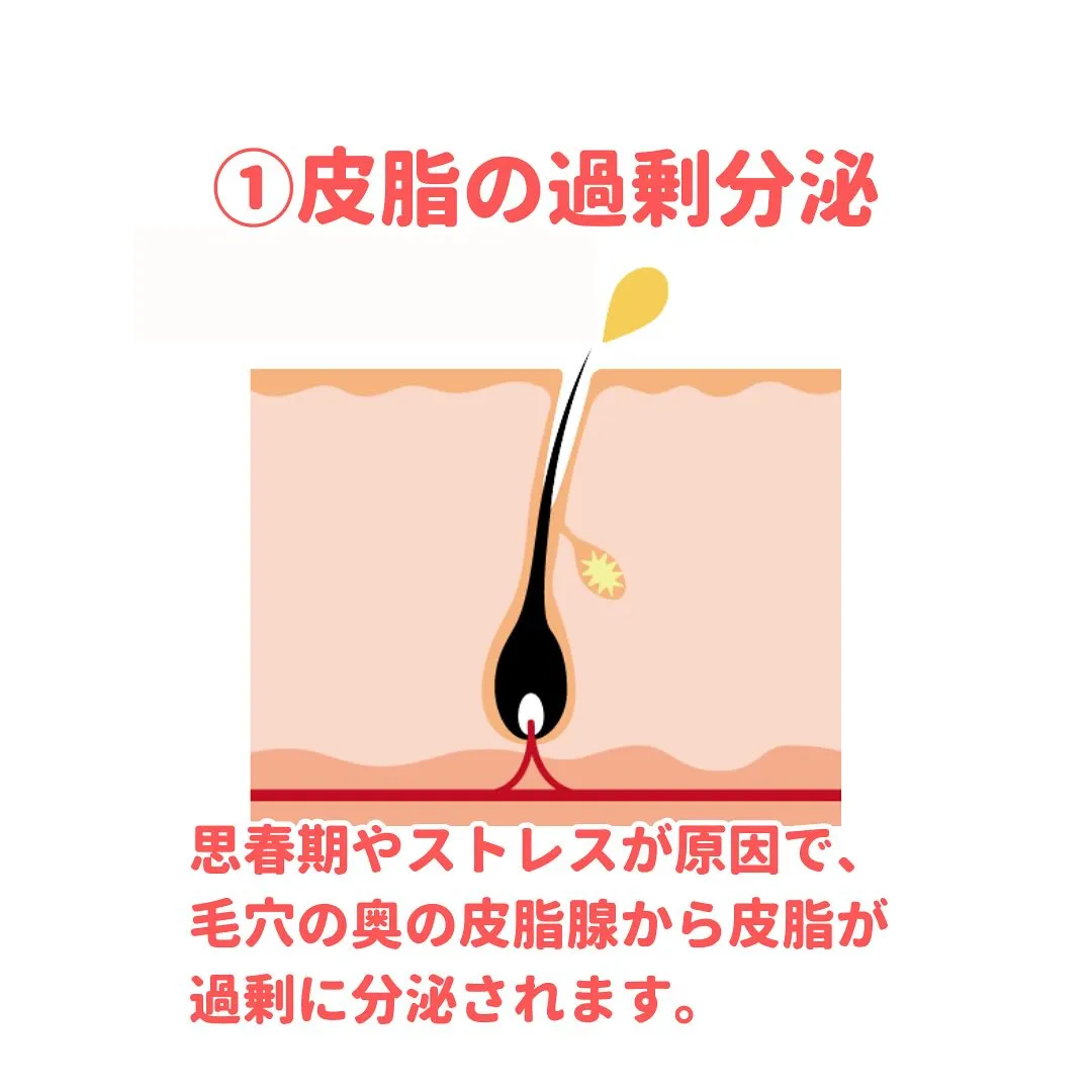 💊 薬剤師が教える身になるミニコラム 💊