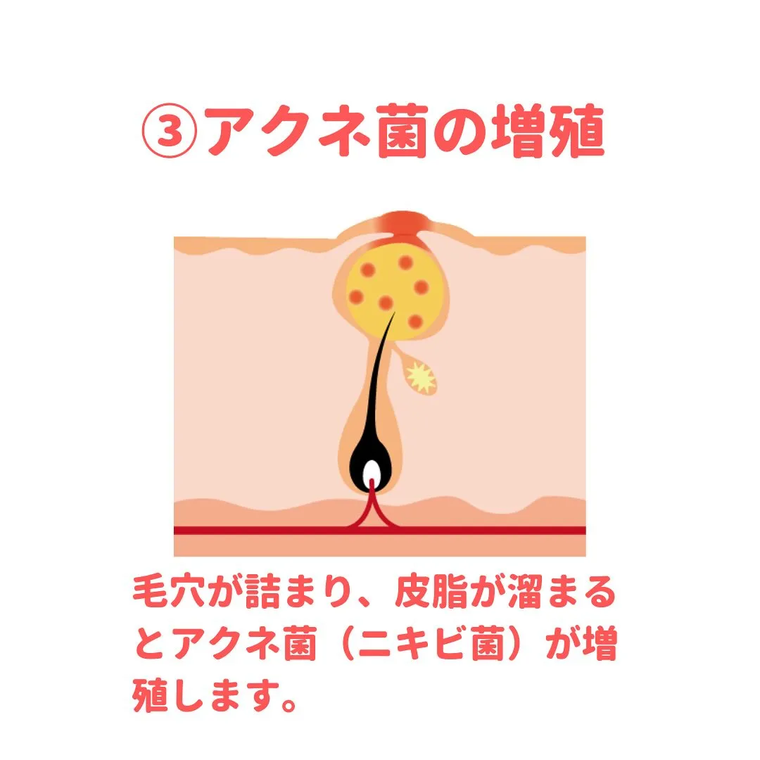 💊 薬剤師が教える身になるミニコラム 💊